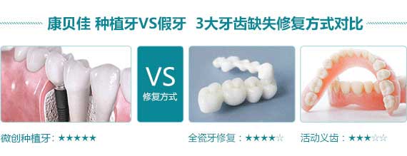 无锡滨湖区普通牙科镶牙价格表